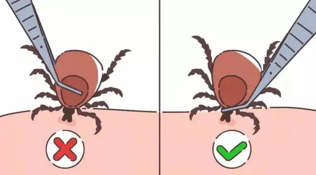 【北京疾控提醒您】小小蜱虫危害大，预防方法要牢记！